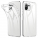 TPU2MM-MI11 - Coque souple Xiaomi Mi 11 en gel épais 2mm flexible enveloppant transparent